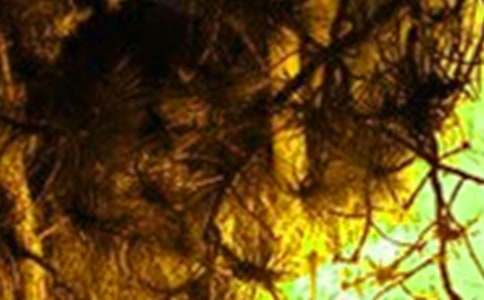 ��������Ӧ��Ԥ��(����15ƪ)