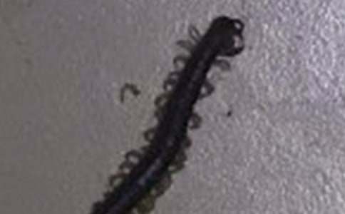 ����򼡷����ͯ���Ķ��⼰��